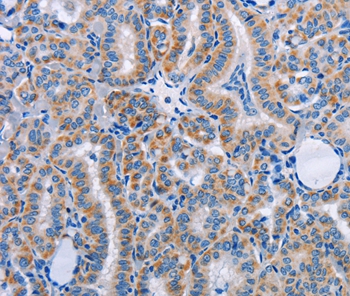 FN1 Antibody[35542]