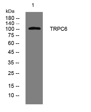 TRPC6 rabbit pAb[48948]