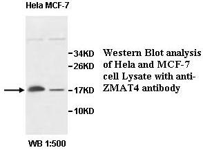 ZMAT4 Antibody[39583]