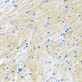 BAG3 Polyclonal Antibody[29195