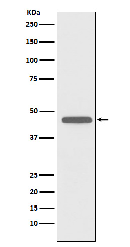 CD83 Rabbit mAb[56444]