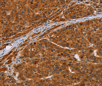NIF3L1 Antibody[36088]
