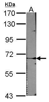 ACVRL1 Antibody[35383]