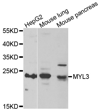 MYL3 antibody[39082]