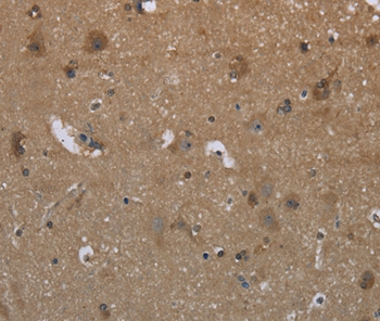 GYS2 Antibody[36509]