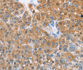 BDH1 Antibody[36279]