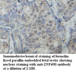 ZNF490 Antibody[39643]