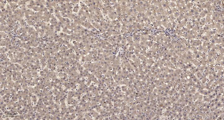 LHPP rabbit pAb[62010]