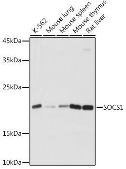 SOCS1 Rabbit Polyclonal Antibo