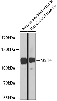MSH4 Rabbit Polyclonal Antibod