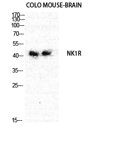 NK-1R Polyclonal Antibody[4124