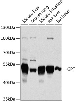 GPT Rabbit Polyclonal Antibody