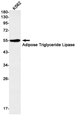 Adipose Triglyceride Lipase Ra