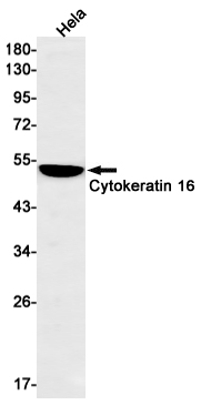 Cytokeratin 16 Rabbit mAb[5206