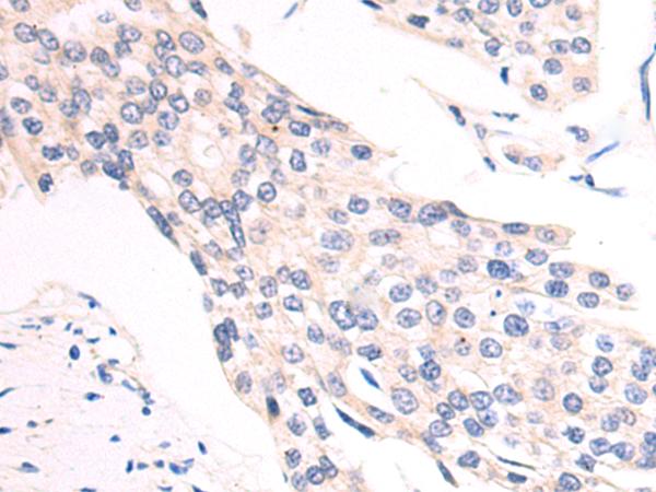 SLC2A6 Antibody[43276]