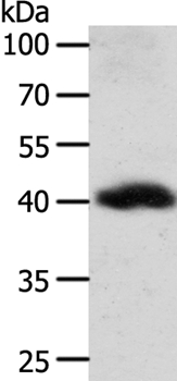 WNT9A Antibody[35983]