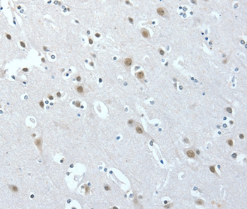 ACLY Antibody[36267]