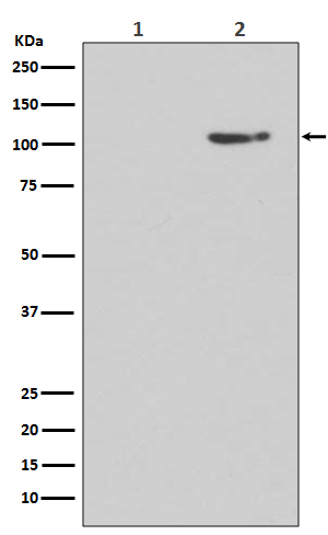 GluR1 (Phospho-Ser845) Rabbit 