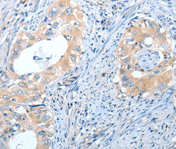 IL13RA2 Antibody[35601]