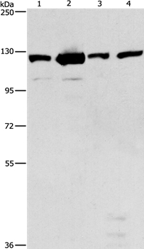 PTK2 Antibody[36214]