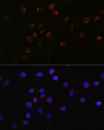CUX1 Rabbit Polyclonal Antibod