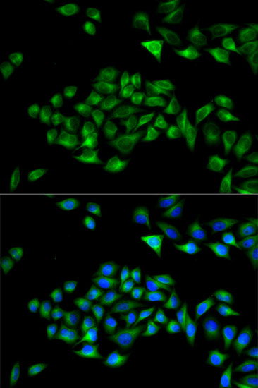 PCM1 Rabbit Polyclonal Antibod