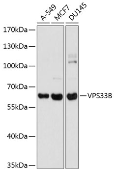 VPS33B Rabbit Polyclonal Antib