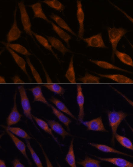 C18orf8 Rabbit Polyclonal Anti
