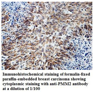 PMM2 Antibody[39827]