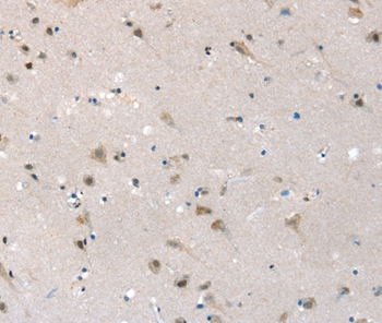 SLC6A7 Antibody[37948]