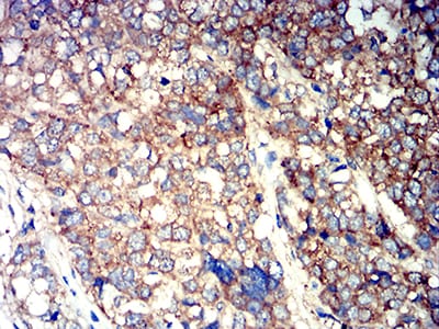 ATG3 Mouse mAb[63105]