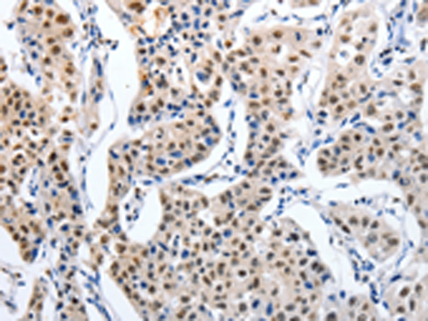 MAGEA6 Antibody[43096]