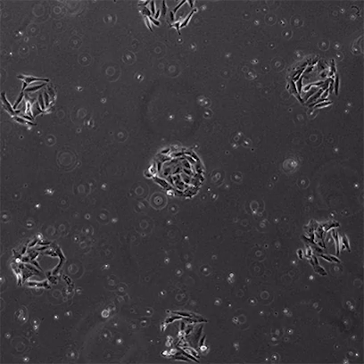 定格癌魔一举一动：从肿瘤微环境到显微视域