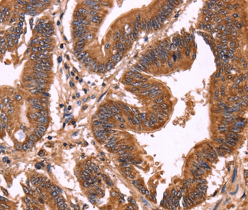 ERP29 Antibody[37555]