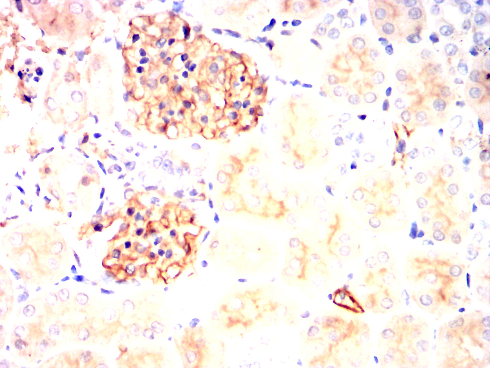 SERPINE1 Mouse mAb[64224]
