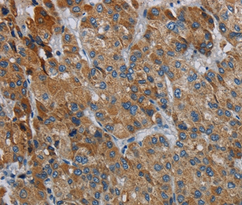 PDSS2 Antibody[37812]