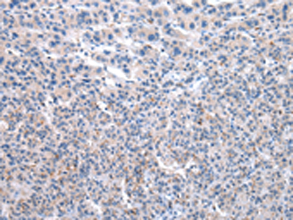 UMPS Antibody[43030]