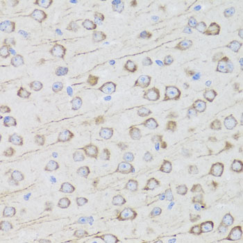 AQP0 antibody[38479]