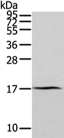 ZFAND2A Antibody[43205]