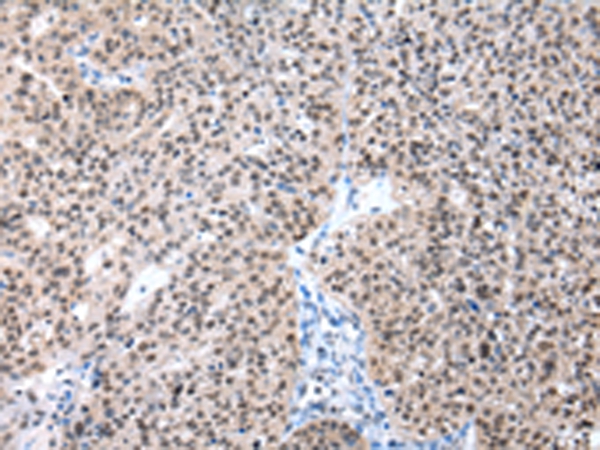 POLE3 Antibody[43062]