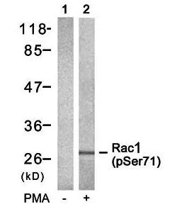 Rac1/CDC42 (phospho-Ser71) rab
