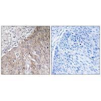 APOL2 Antibody[34432]