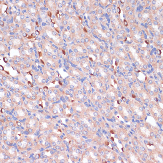 PIK3R2 Rabbit Polyclonal Antib