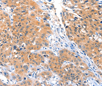 ACOX3 Antibody[36022]