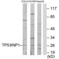 TP53INP1 Antibody[34022]