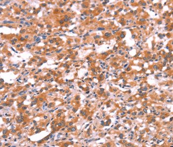 GABRG2 Antibody[37584]