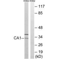 CA1 Antibody[34537]
