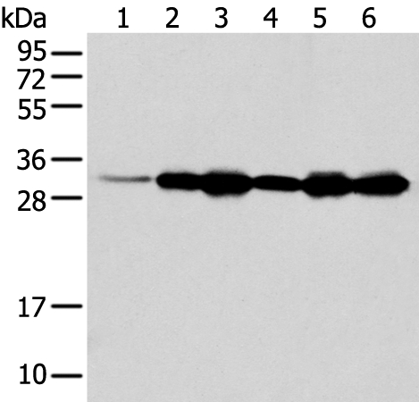 NUDT22 Antibody[42945]