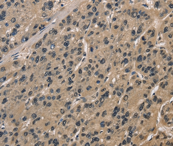 CCAR1 Antibody[36417]