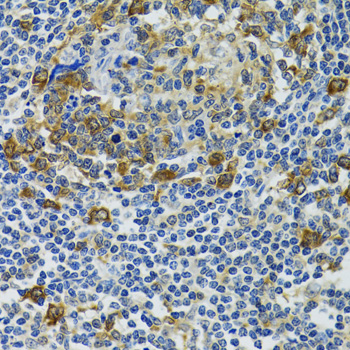 HSPH1 antibody[39052]